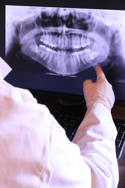 Best Emergency Root Canal Treatment in Redmond, WA